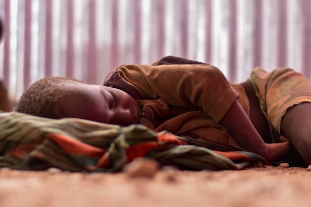 Photo child mortality diarrhea